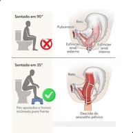Banquinho Auxiliar para Vaso Sanitário - Melhora Postura e Conforto com Design Universal - imagem 5